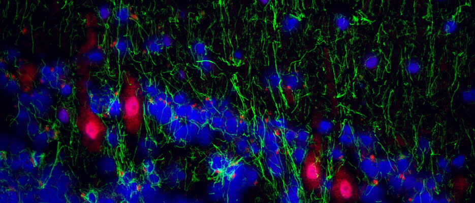 Immunofluorescence image from the cerebellar cortex region of bipolar patients that shows proteins of human herpesviruses in Purkinje neurons.