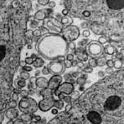 Bild 2 von Elektronen Mikroskopische Aufnahme unzähliger Vesikel, die sich nach Ausschalten des PAD-1 Proteins zwischen den Zellen eines C. elegans Embryos ansammeln.