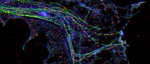 High-resolution microscopy of an axon terminal of a cultivated motor neuron. Microtubules are dyed with green fluorescent dye, Stathmin is blue, Stat-3 red.
