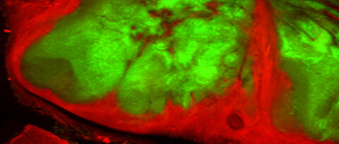 A new approach against cancer: Vaccinia viruses (green) fight tumour cells. (Photo: AG Szalay)