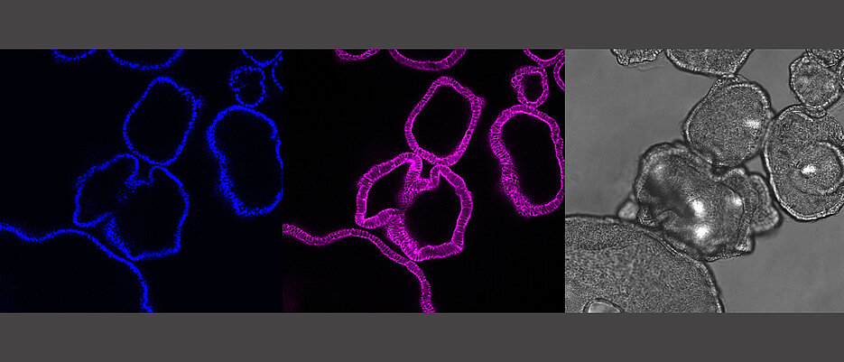 Die Bilder zeigen die jeweils gleichen Magen-Organoide: Es zeigt die Zellkerne (blau) und das Skelett der Zelle (pink) als Querschnitt aus den Organoiden. In grau ist das mikroskopische Bild der Organoide. Bei diesen Magen-Organoiden ist ein einzelnes Organoid etwa ein Viertel Millimeter groß.