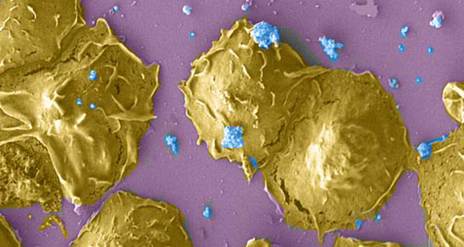 Polymorphic nuclear leukocytes infected with Chlamydia (blue). (Photo: Karthika Rajeeve)