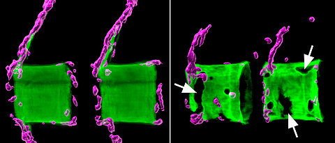 Links zwei gesunde Wirbelkörper aus der Wirbelsäule eines Medaka-Fisches: Die Knochenmatrix (grün) ist normal mineralisiert und von knochenbildenden Zellen (magenta) umgeben. Rechts die Situation bei einem osteoporotischen Fisch.