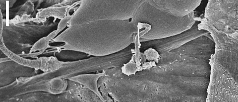 Das larvale Drosophila Chordotonalorgan, aufgenommen mit dem Rasterelektronenmikroskop. In dieser sensorischen Funktionseinheit wird die Verarbeitung von mechanischen Reizen durch den Latrophilin-Rezeptor moduliert. Maßstab: 10 µm. (Foto: Scholz et al.,