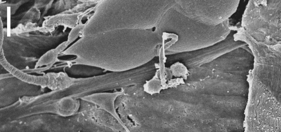 Das larvale Drosophila Chordotonalorgan, aufgenommen mit dem Rasterelektronenmikroskop. In dieser sensorischen Funktionseinheit wird die Verarbeitung von mechanischen Reizen durch den Latrophilin-Rezeptor moduliert. Maßstab: 10 µm. (Foto: Scholz et al.,