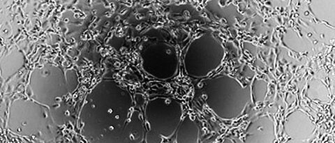 BOECs tube formation showing vasculogenesis ability.