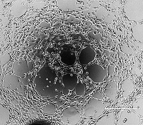 BOECs tube formation showing vasculogenesis ability.