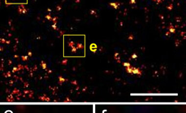 Mit Fluoreszenz-Farbstoffen markierte 2B-Histone im Kern einer lebenden Zelle: Oben ein Ausschnitt aus der vorherigen Abbildung, in der weiteren Vergrößerung (e, f) sind einzelne Histon-Moleküle erkennbar. Der weiße Messbalken entspricht 200 Nanometer