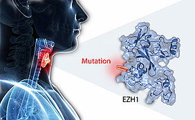 Eine Mutation in dem EZH1-Gen ist der zweithäufigste genetische Defekt in autonomen Adenomen. Dies haben Wissenschaftler der Uni Würzburg jetzt gezeigt. (Abbildung: Davice Calebiro / Kerstin Bathon)