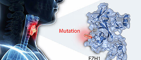 A significant number of autumnous adenomas carry a mutation in a gene that is involved in controlling cell proliferation and differentiation. EZH1 – or Enhancer of Zeste Homolog 1 – is the scientific name of this gene.