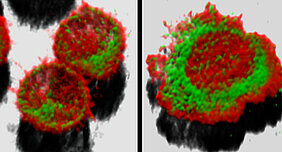 Krankheitserreger verändern im Menschen die Zellmembranen: Die dreidimensionalen Rekonstruktionen zeigen T-Lymphozyten (links ruhend, rechts durch Erreger aktiviert) mit dem Zellskelett aus Aktin (rot) und mit „geköpften“ Sphingolipiden (grün). (Bi
