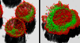 T Lymphocytes