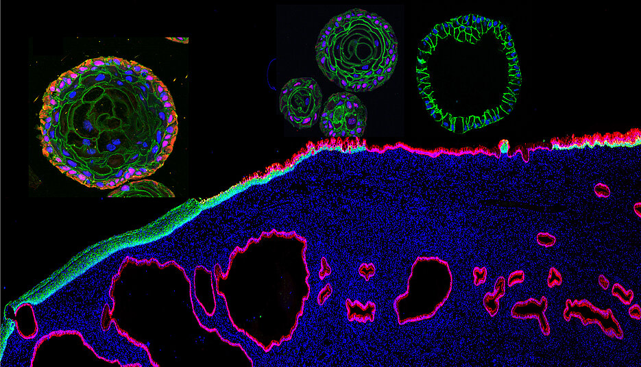 Image of human cervix tissue and organoids derived from ectocervical stratified squamous (green) and endocervical columnar (red) epithelial stem cells.