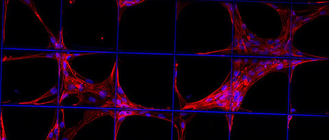 Vorläuferzellen des Stütz- und Bindegewebes (z.B. Knochen, Knorpel, Muskel, Bändern, Sehnen) auf einem Konstrukt aus biologisch abbaubarem Kunststoff (Quelle: Universitätsklinikum Würzburg)