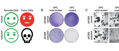 If the eIF2B5 gene is inhibited, the colon cancer cells with an APC mutation do not do well: they die. On the left a schematic representation, in the middle cell cultures, on the right organoids