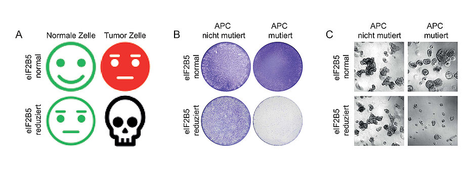 Wird das Gen elF2B5 gehemmt, bekommt das Darmkrebszellen mit einer APC-Mutation nicht gut: Sie sterben ab. Links eine schematische Darstellung, in der Mitte Zellkulturen, rechts Organoide.