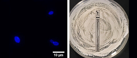 Infections with Candida auris are difficult to treat and potentially life-threatening. The picture shows yeast cells of C. auris on the left and a fluconazole-resistant C. auris strain on the right. 
