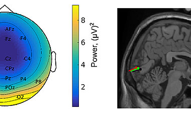 Die Topographie der EEG-Antwort (links) und ihre Lokalisation im Gehirn (rechts) zeigen visuelle Verarbeitungsprozesse während verschiedenen Bewegungsbedingungen: langsames und normales Gehen – grün und rot; Stehen – schwarz.
