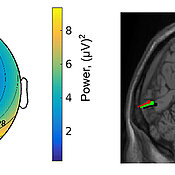 Die Topographie der EEG-Antwort (links) und ihre Lokalisation im Gehirn (rechts) zeigen visuelle Verarbeitungsprozesse während verschiedenen Bewegungsbedingungen: langsames und normales Gehen – grün und rot; Stehen – schwarz.