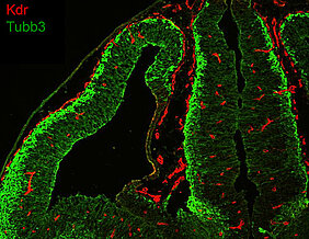 Verteilung von Endothelzellen und neuronalen Zellen im Gehirn der erwachsenen Maus. (Foto: AG Gessler)