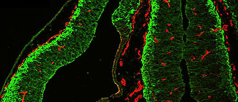 Verteilung von Endothelzellen und neuronalen Zellen im Gehirn der erwachsenen Maus. (Foto: AG Gessler)