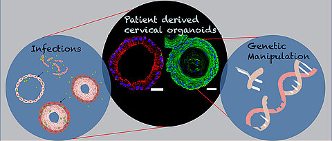 Das Bild zeigt von Patientinnen gewonnene endozervikale säulenförmige (rot) und ektozervikale geschichtete Plattenepithelorganoide (grün) des weiblichen Fortpflanzungstrakts. Das Diagramm verdeutlicht deren Rolle für genetische Manipulationen und bei Infektionen. 
