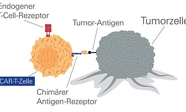 Durch einen Chimären Antigen-Rezeptor können T-Zellen Tumorzellen erkennen und zerstören. 
