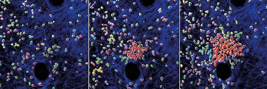 Individual neutrophils attract more cells to initiate the formation of a neutrophil swarm and cluster in living mouse tissue. Snapshots of a 30 minutes time sequence are shown. Individual neutrophils (multicolored), neutrophil clusters (red) and structural components of the mouse skin (blue) are displayed.