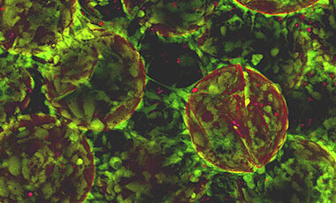Humane induzierte pluripotente Stammzellen (hiPS) auf Mikrocarriern (Bild: Fraunhofer IBMT)