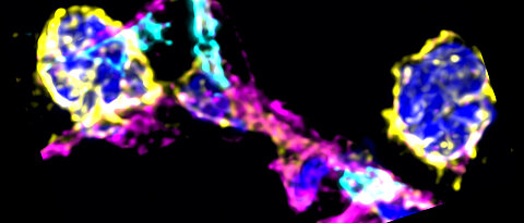 Die fluoreszenzmikroskopische Aufnahme rechts zeigt die Interaktion von Thrombozyten (cyan) mit Entzündungszellen (gelb) im Lungengewebe, sowie eine eingewanderte Entzündungszelle außerhalb des Blutgefäßes (magenta) innerhalb des Lungenbläschens.