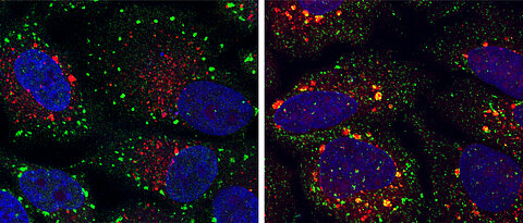 Farbige Mikroskopie-Aufnahmen, die Zellen mit normalen (grüne Punkte) und abnormalen (gelbe Punkte) Stressgranula zeigen. (Foto: AG Buchberger)