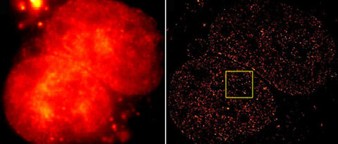 Gewaltiger Unterschied: Links eine herkömmliche Fluoreszenz-Aufnahme der 2B-Histone im Zellkern, rechts die superaufgelöste Variante, erstellt aus 10.000 Einzelaufnahmen mit der Methode dSTORM (direct stochastic optical reconstruction microscopy). Bilde