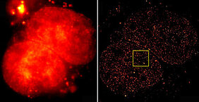 Gewaltiger Unterschied: Links eine herkömmliche Fluoreszenz-Aufnahme der 2B-Histone im Zellkern, rechts die superaufgelöste Variante, erstellt aus 10.000 Einzelaufnahmen mit der Methode dSTORM (direct stochastic optical reconstruction microscopy). Bilde