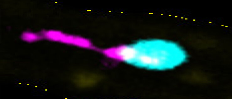 Intravitalmikroskopische Aufnahme aus der Leber eines Mausmodells: Ein Thrombozyt (türkis) haftet an der entzündeten Gefäßwand (gelb gestrichelt) und schnürt einen langen, fadenförmigen Membranfortsatz ab – einen sogenannten PITT (magenta). Diese von Thrombozyten freigesetzten Integrin- und Tetraspanin-reichen Tethers bleiben an der Gefäßwand zurück und fördern Entzündungsreaktionen, während sich der Thrombozyt selbst wieder in den Blutstrom löst. Maßstab: 1 µm. 