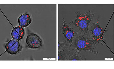 Polymere Nanopartikel (rot) können von Immunzellen (Zellkern blau) aufgefressen und dann von ihnen abgebaut werden (links). Wenn sie mit einem Immunstimulanz beladen sind, wecken sie die Immunzellen aus ihrem Schlaf (rechts).