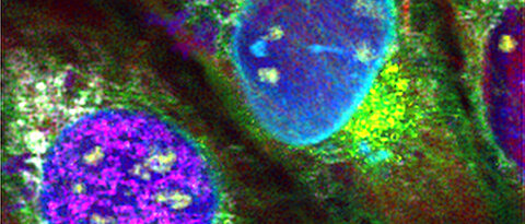 Einmalig: Neun verschiedene Zellstrukturen wurden in einem Aufwasch fluoreszenzmarkiert und damit mikroskopisch unterscheidbar gemacht. (Bild: Thomas Niehörster)