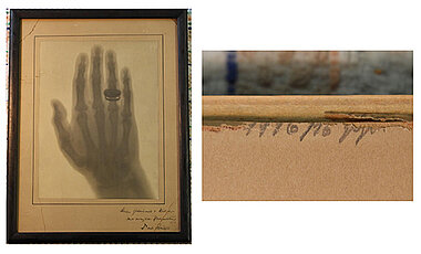 Berühmt: Eine der ersten Röntgenaufnahmen zeigt Albert von Köllikers Hand. Rechts die Markierung, die vom Rahmen des Bildes verdeckt war. 