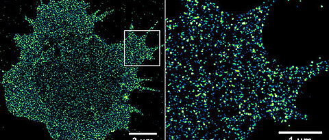 Immune receptors on a cancer cell. Using high-resolution fluorescence microscopy, it is possible to visualize and quantify receptors in the cell membrane with single-molecule sensitivity. (Picture: Sebastian Letschert)