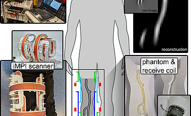 The iMPI scanner is so small and light that you can take it with you and use it almost anywhere. This is a first important step towards radiation-free intervention.