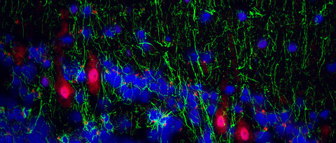 Immunofluorescence image from the cerebellar cortex region of bipolar patients that shows proteins of human herpesviruses in Purkinje neurons.