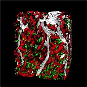 Picture of an Light Sheet Fluorescence Microscopy (LSFM): Reconstruction of a sternum bone (detailed view); megakaryocytes (green) mostly attached to vessels (red); bone structure depicted in grey. Photo: Heinze Group