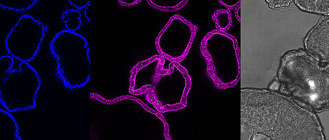 Die Bilder zeigen die jeweils gleichen Magen-Organoide: Es zeigt die Zellkerne (blau) und das Skelett der Zelle (pink) als Querschnitt aus den Organoiden. In grau ist das mikroskopische Bild der Organoide. Bei diesen Magen-Organoiden ist ein einzelnes Organoid etwa ein Viertel Millimeter groß.