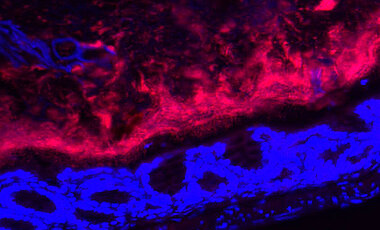 Die Mikrobiota des Darms unter dem Mikroskop. Rot gefärbt sind die Bakterien zu sehen, der Darm  ist blau. 