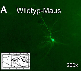 Im Vergleich zu Masernvirus-infizierten Hirnen normaler Mäuse (A), in denen nach 28 Tagen nur wenige Neurone infiziert sind (grün fluoreszierend), sind aufgrund der eingeschränkten Immunantwort in ASM-defizienten Mäusen wesentlich mehr Neurone infizie