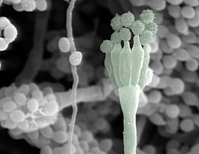 Der Pilz Aspergillus in einer mikroskopischen Aufnahme. (Foto: Medizinische Klinik II)