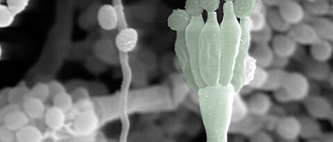 Der Pilz Aspergillus in einer mikroskopischen Aufnahme. (Foto: Medizinische Klinik II)