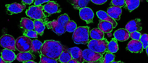 Expression of GLUT3 on activated T cells. GLUT3 (green) is localised on the cell surface, the mitochondria (violet) and the nucleus (blue) were also shown. Photo: AG Väth