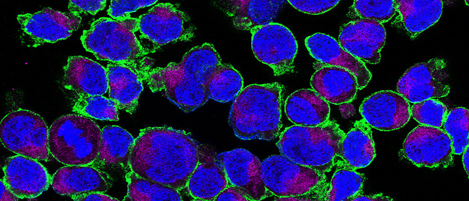 Expression von GLUT3 auf aktivierten T-Zellen. GLUT3 (grün) ist auf der Zelloberfläche lokalisiert, die Mitochondrien (violett) und der Kern (blau) wurden ebenfalls dargestellt.