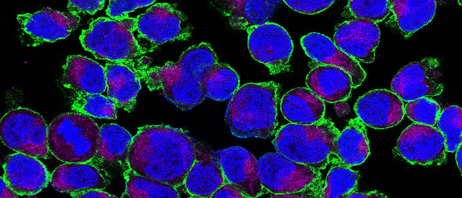 Expression of GLUT3 on activated T cells. GLUT3 (green) is localised on the cell surface, the mitochondria (violet) and the nucleus (blue) were also shown. Photo: AG Väth