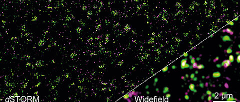 The distribution of the glutamate receptor mGluR4 and other proteins in the presynaptic membrane Left a high-resolution dSTORM image. On the right, the result obtained with conventional fluorescence microscopy – molecular details are not visible here. 